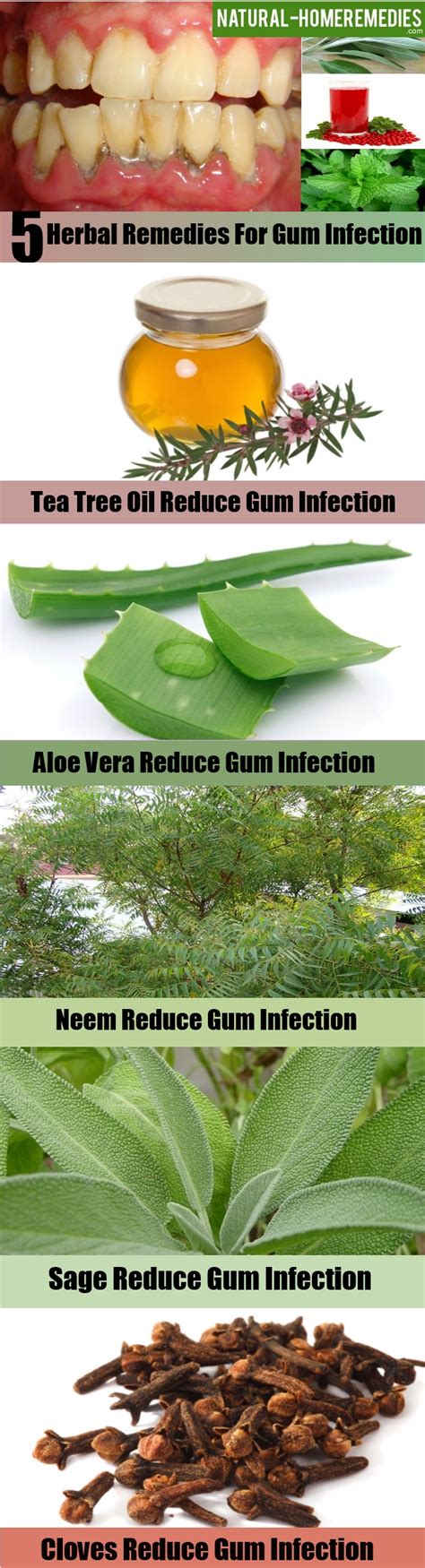 Top 5 Herbal Remedies For Gum Infection Natural Home Remedies