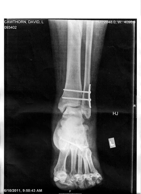 David Cawthorn - David Cawthorn added a new photo.