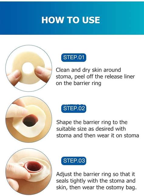 Konweda Ostomy Barrier Rings 2 48mm Outer Diameter 4mm Thickness