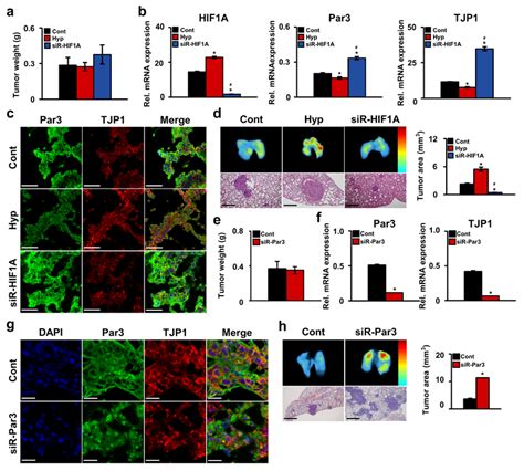 Effects Of Hif And Par On Oscc Tumor Metastasis In Vivo Hsc