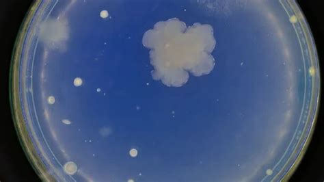 growth of bacteria in a petri dish sampl... | Stock Video | Pond5