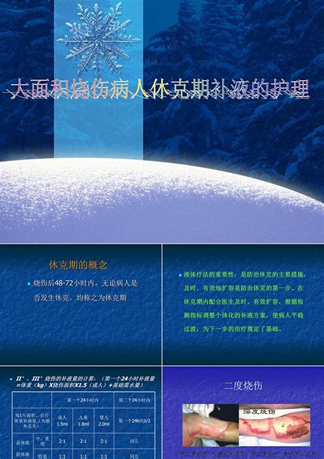 大面积烧伤病人休克期补液的护理ppt模板 卡卡办公