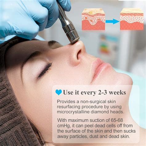 Snapklik Upgraded Diamond Microdermabrasion Machine Mcwdoit