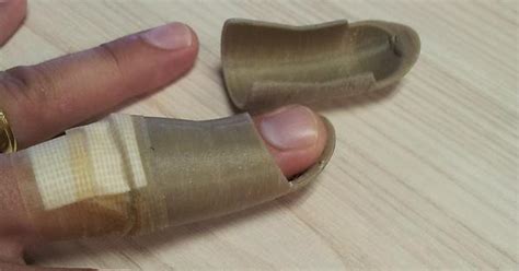 3d Printed Custom Finger Splints Imgur