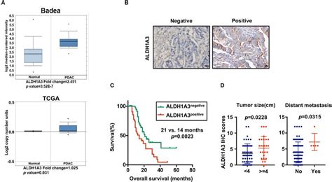 High Expression Of ALDH1A3 Is Correlated With Poor Prognosis In PDAC