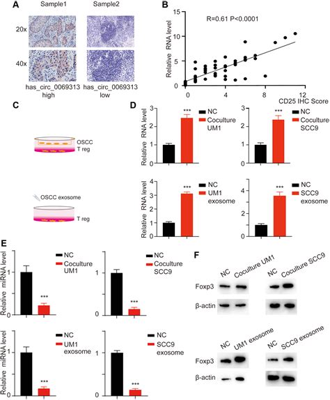 CircRNA Has Circ 0069313 Induced OSCC Immunity Escape By MiR 325 3p