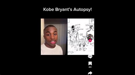 Kobe Bryant Autopsy 🤯 Roadto100subs Youtube