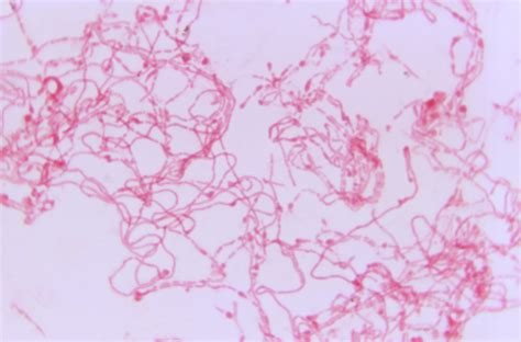 Streptobacillus moniliformis — Superbugs - The microbial world in, on ...