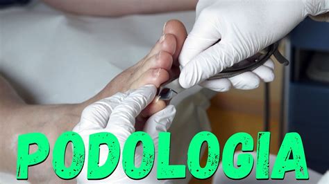 PODOLOGIA LIVE Como tratar um Granuloma CURSO Fórmula Podologia de