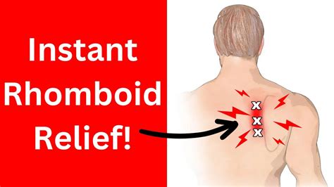 Fix Rhomboid Pain With 2 Exercises YouTube