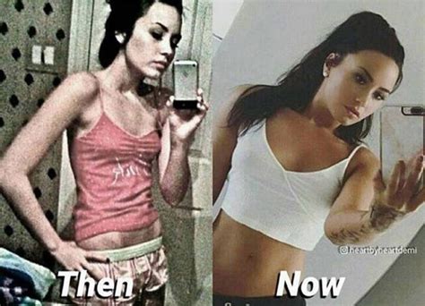 La Impactante Foto Que Demi Lovato Compartió Con Su Antes Y Después De