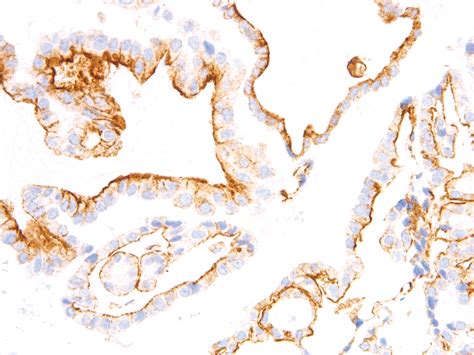 BRAF V600E Antibody - FemtoPath | HongJing弘晉