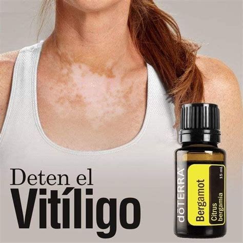 Pin De Magdalena B En Magd Terra Aceites Esenciales Doterra Recetas