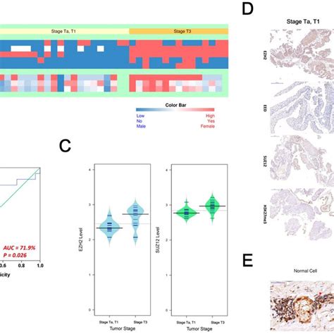 An Evaluation Of PRC2 Oncogenic Signature In Upper Tract Urothelial