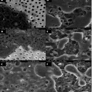 Photomicrographs Obtained By Scanning Electron Microscopy SEM Of The