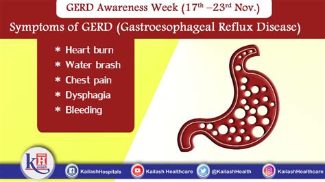 Early Diagnosis Of Gastroesophageal Reflux Disease Can Help In Better Management Know About The