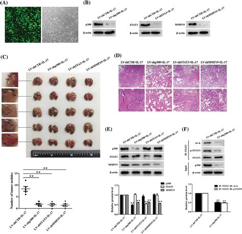 Or Free Full Text Il Induces Nsclc Cell Migration And Invasion