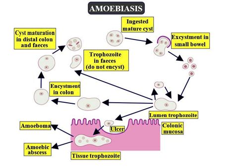 Amebiasis Chart