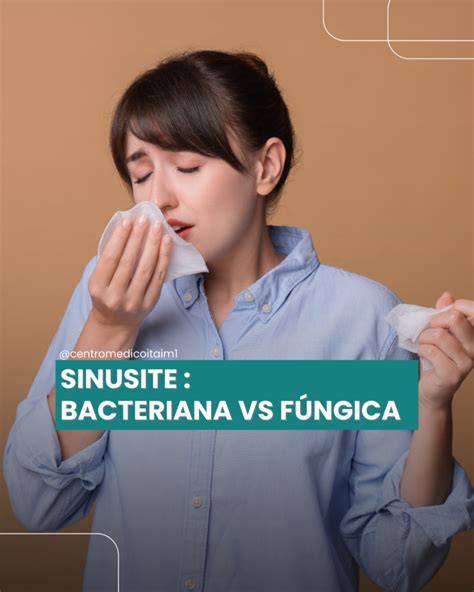 Como Saber Se A Sinusite É Bacteriana - Sinusite bacteriana e sinusite fúngica: entenda as diferenças e quando ...