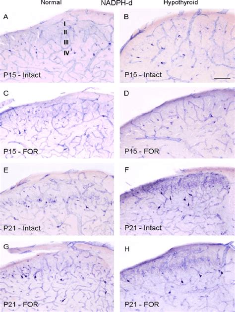 Representative Photomicrographs Showing Nadph D Reactive Cells In The