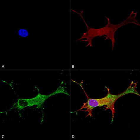 Anti Notch Antibody Qed Bioscience Inc