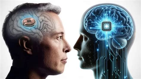 Elon Musk confirms that Neuralink's brain chip has been successfully ...