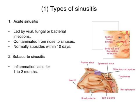 Ppt Know Your Sinusitis Corrected Powerpoint Presentation Free