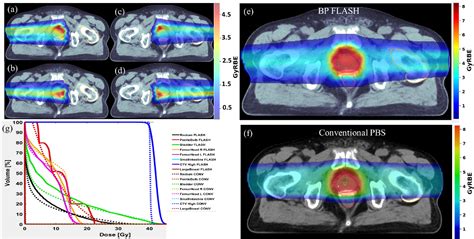 Figure 1 From Pencil Beam Scanning Proton Bragg Peak Conformal Flash In Prostate Cancer