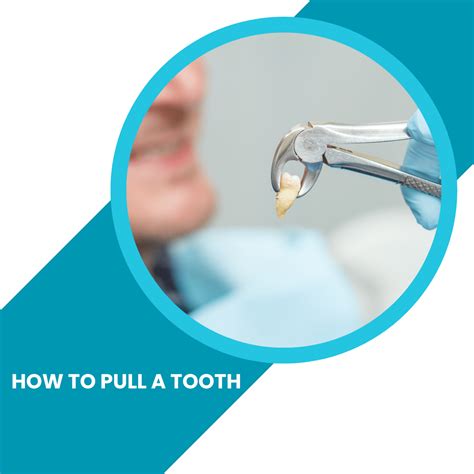 How To Pull A Tooth Extraction Types Risks And Cost Toothfeed