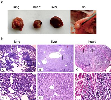 Systemic Injection Of Hepa1 6 Cells In Syngeneic C57bl6 Mice Hepa1 6