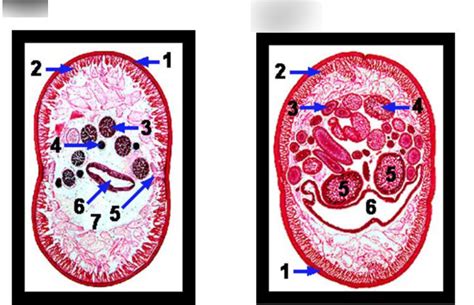 Ascaris Diagram Quizlet