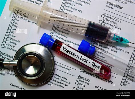 Western Blot Test With Blood Sample Top View Isolated On Office Desk