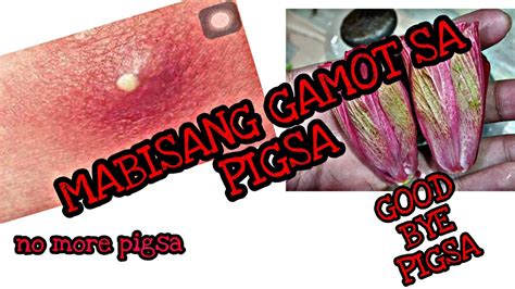 Mabisang Gamot Sa Pigsa Youtube