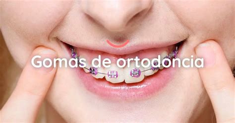 Gomas Clase Ortodoncia Funci N Y Colocaci N Dentaline