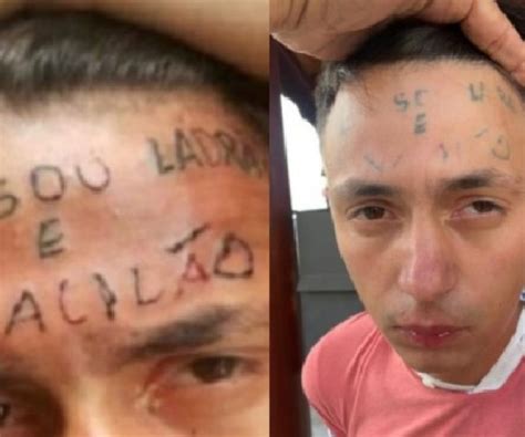 Notícias Homem que teve a testa tatuada sou ladrão e vacilão é