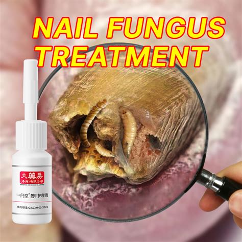 Nail Fungus Treatment Best Nail Repair Stop Fungal Growth Effective