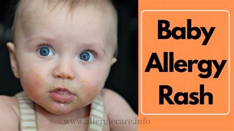 Common Allergy Baby Rash & Best way to Cure - Allergie Care