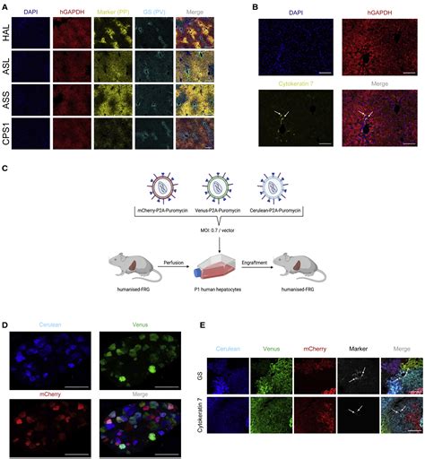 Characterization Of The Humanized FRG Mouse Model And Development Of An