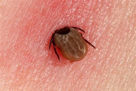 Tick Bite Pictures Symptoms Treatments Prevention