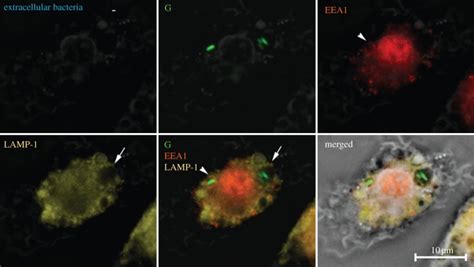 Salmonella Typhimurium Are Contained In Salmonella Containing Vacuoles Download Scientific