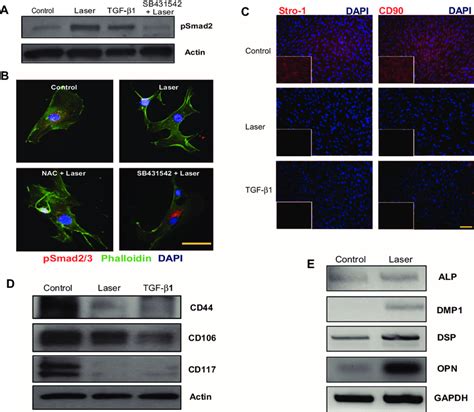 LPL Induced Odontoblastic Differentiation Of Human Dental Stem Cells