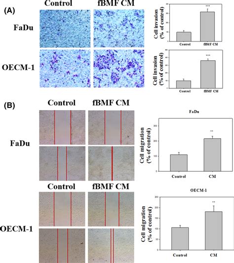 OSF Increased The Invasion And Migration Of FaDu And OECM1 Cells A