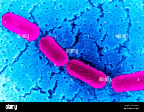 Clostridium Botulinum Bacterium Fotos E Imágenes De Stock Alamy