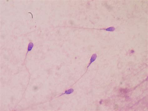 Andrology And Semen Analysis Microscopes