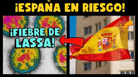 Alerta Espa A En Riesgo Por Otra Enfermedad Viral Fiebre De Lassa