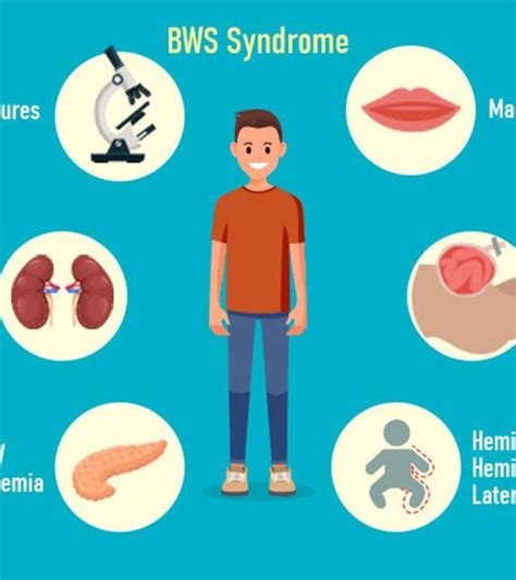 Beckwith-Wiedemann Syndrome: Symptoms, Causes And Treatment