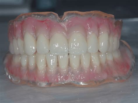 Bespoke Denture Design Laboratory The Hive Dental Laboratory