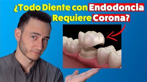 Empaste O Endodoncia Descubre C Mo Saber Cu L Necesitas Todopost