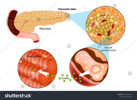 Illustration Insulin Production Pancreas Metabolic Actions Stock Vector (Royalty Free) 1223649661