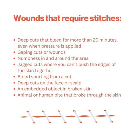 Stitches — ER or Urgent Care? — Premier